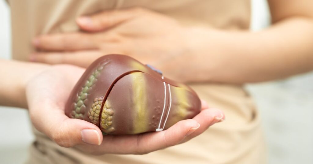 Ayurvedic Treatment for Fatty Liver